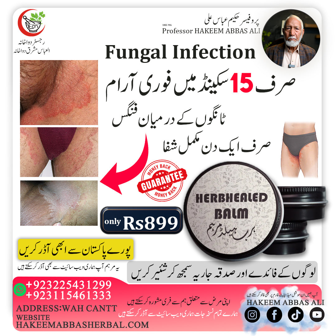 Fungal Infection ٹانگوں کے درمیان